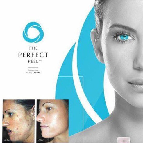 The perfect peel