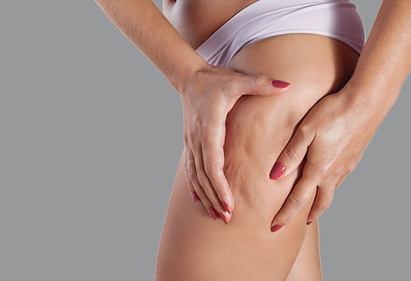 Cellulite-Treatment-services