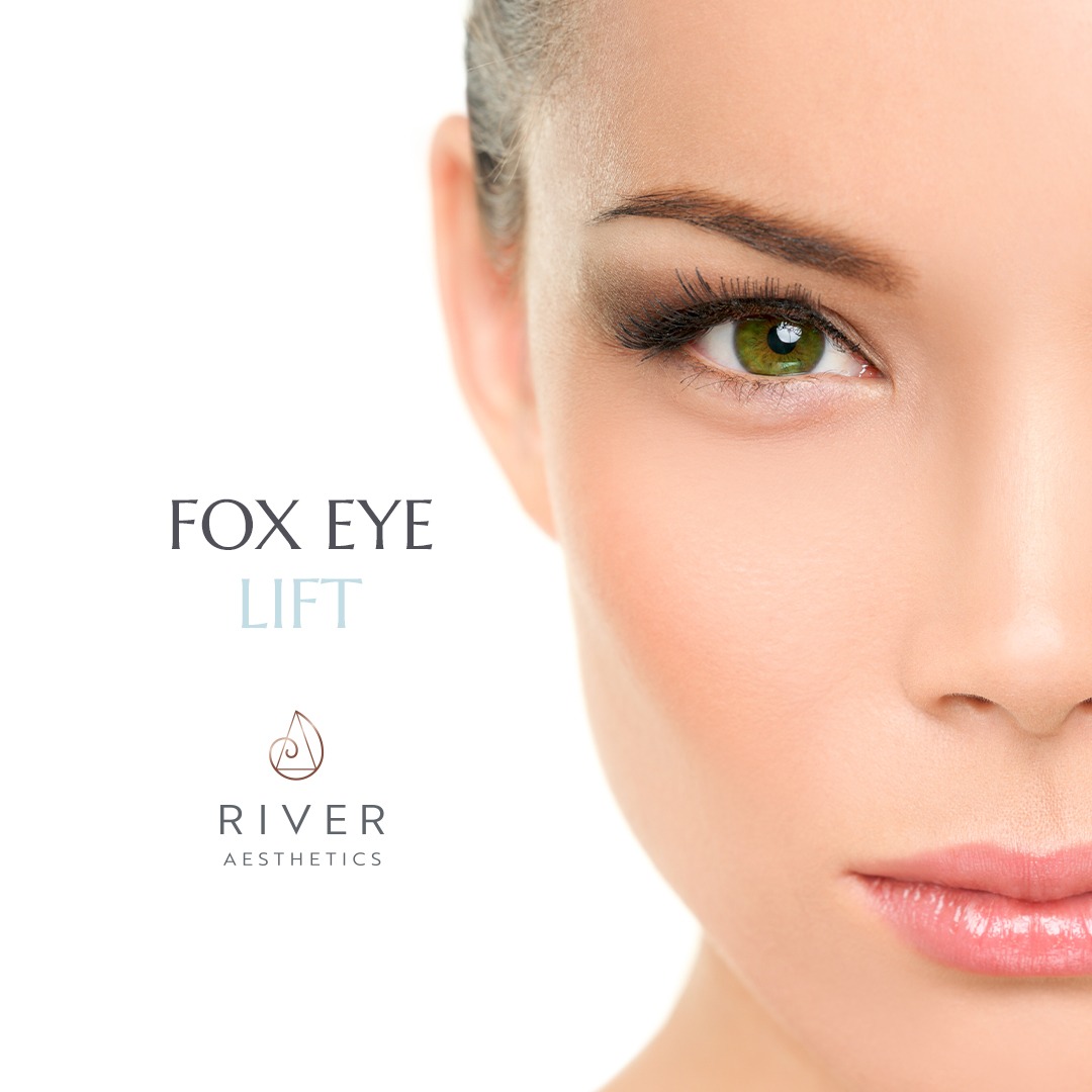 fox eye lift by river aesthetics