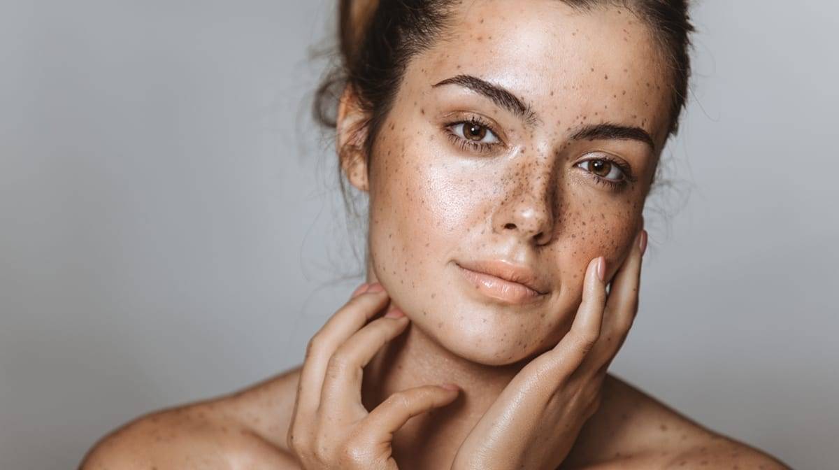 IPL Skin Pigmentation Treatment